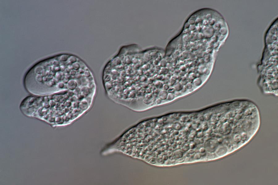 Entamoeba Histolytica Photograph - Entamoeba Histolytica Protozoa #1 by Sinclair Stammers