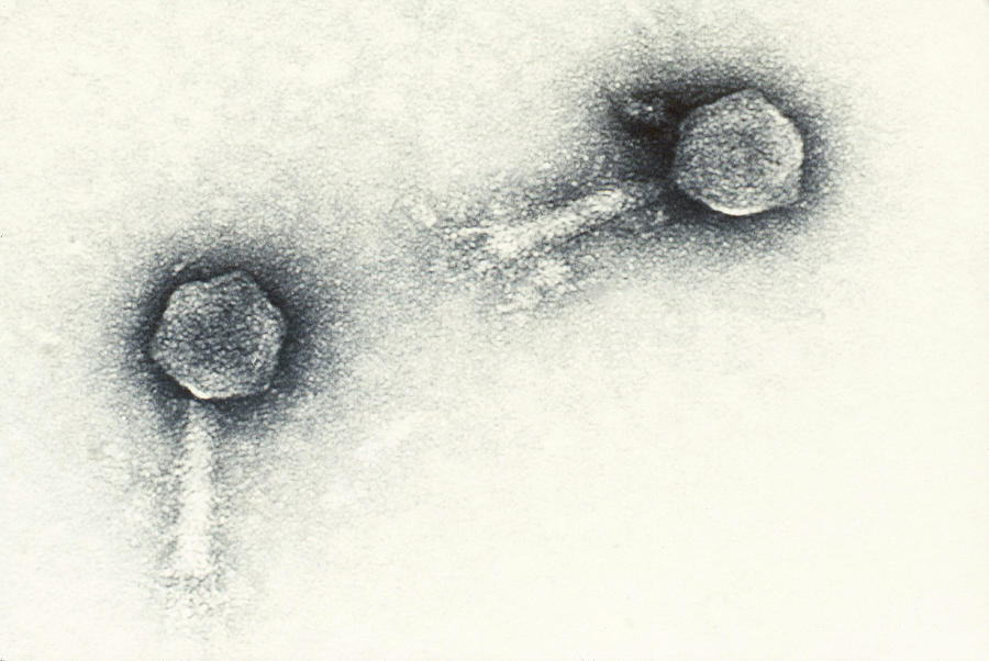 Enteriobacteria Phage P1 Tem #1 Photograph by Biology Pics