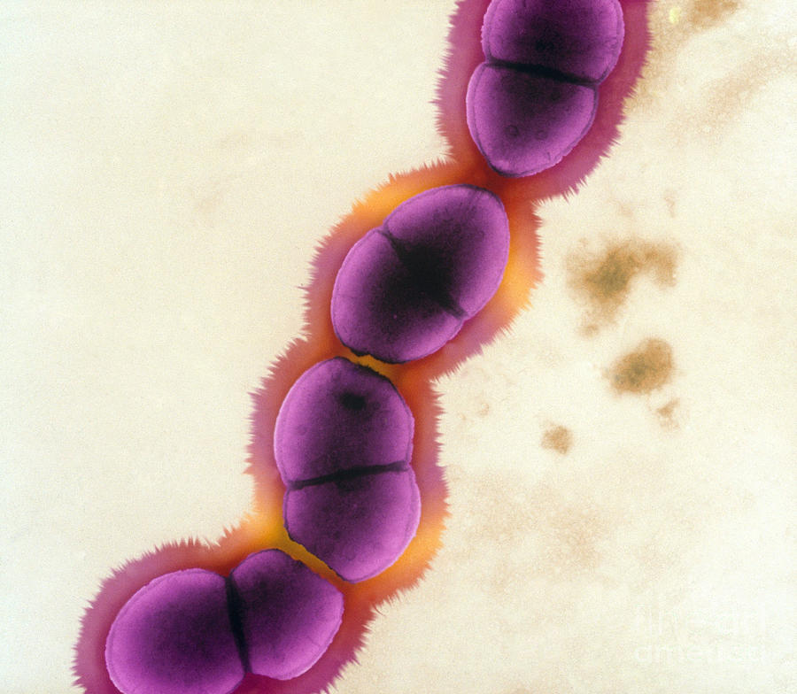 Enterococcus Faecalis, Tem #1 Photograph by Kwangshin Kim