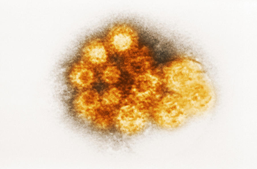 Enterovirus, Tem #1 Photograph by Science Source