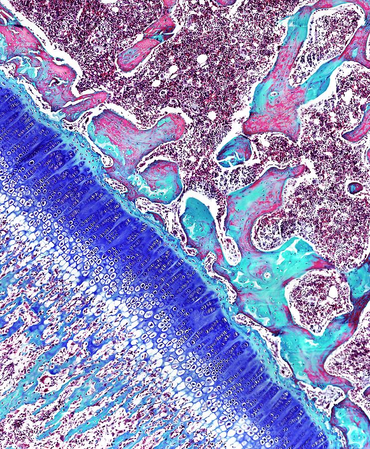Epiphyseal Growth Plate #1 Photograph by Microscape
