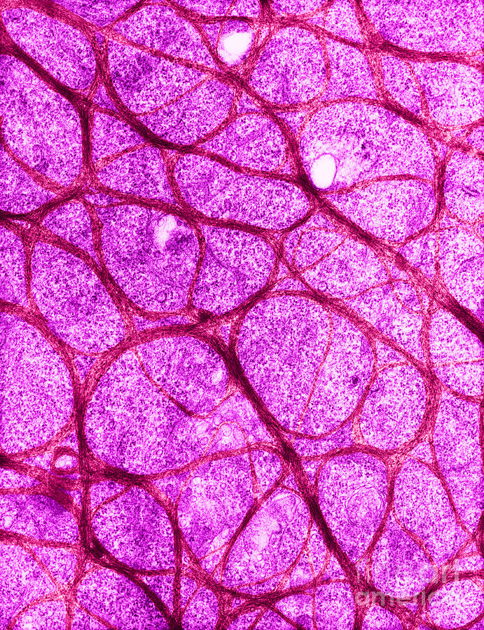 Epithelial Cell From Cervix, Tem #1 Photograph by David M. Phillips