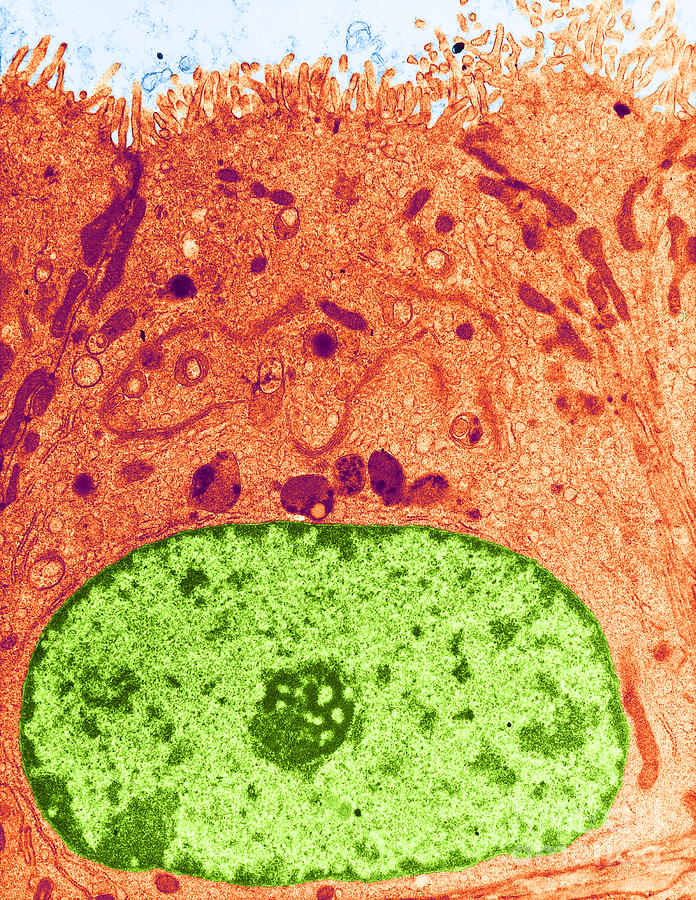Epithelial Cell, Tem #1 Photograph by David M. Phillips