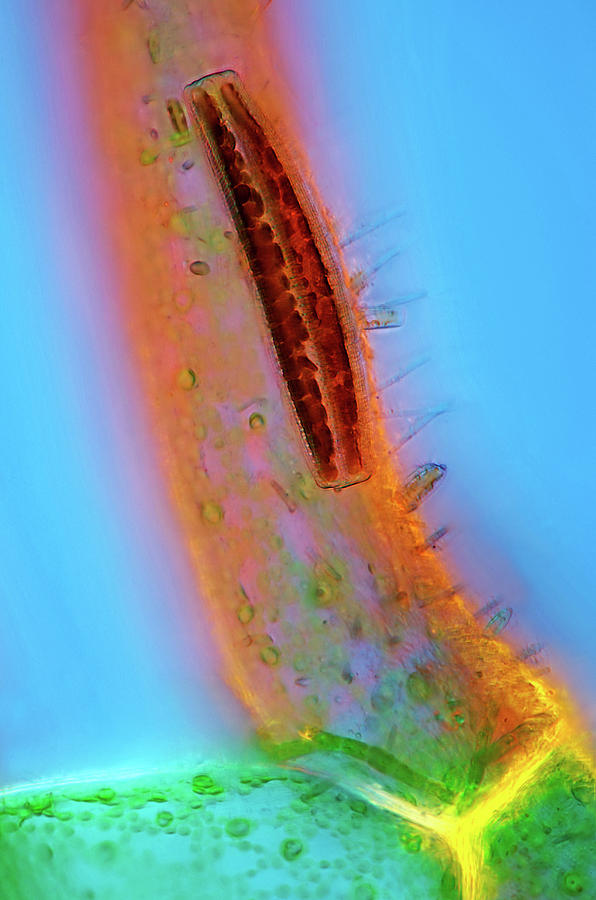 Epithemia Diatom #1 Photograph by Marek Mis