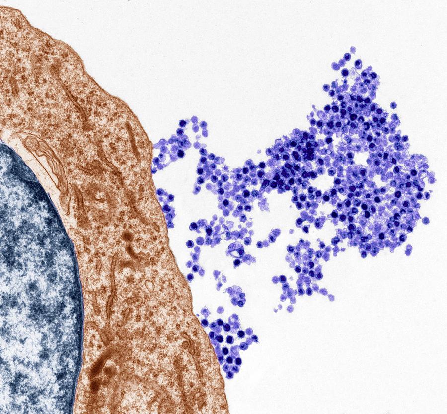 Epstein-barr Virus #1 Photograph by Steve Gschmeissner