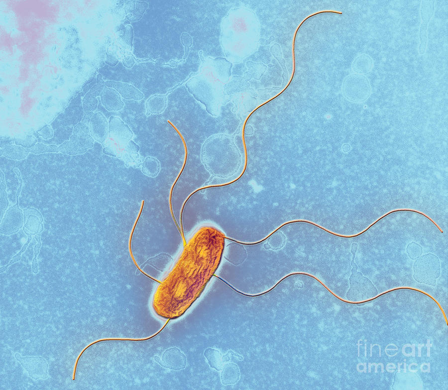 Bacteria Photograph - Escherichia Coli Strain #2 by Kwangshin Kim