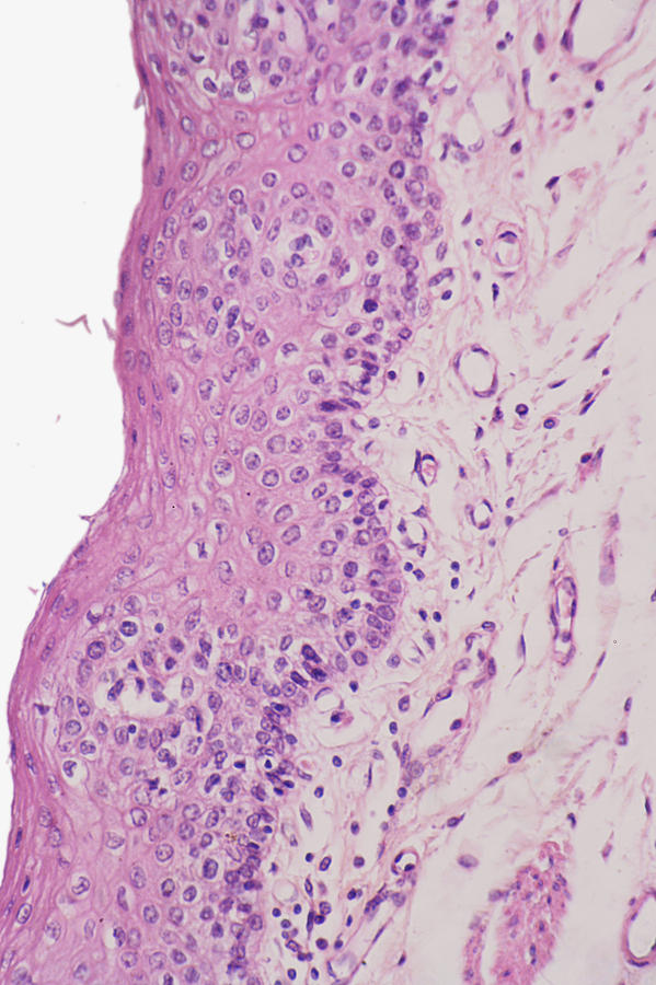 Esophagus, Lm #1 Photograph by Science Stock Photography