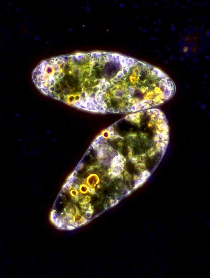 Animal Photograph - Euglena protozoa, light micrograph #1 by Science Photo Library
