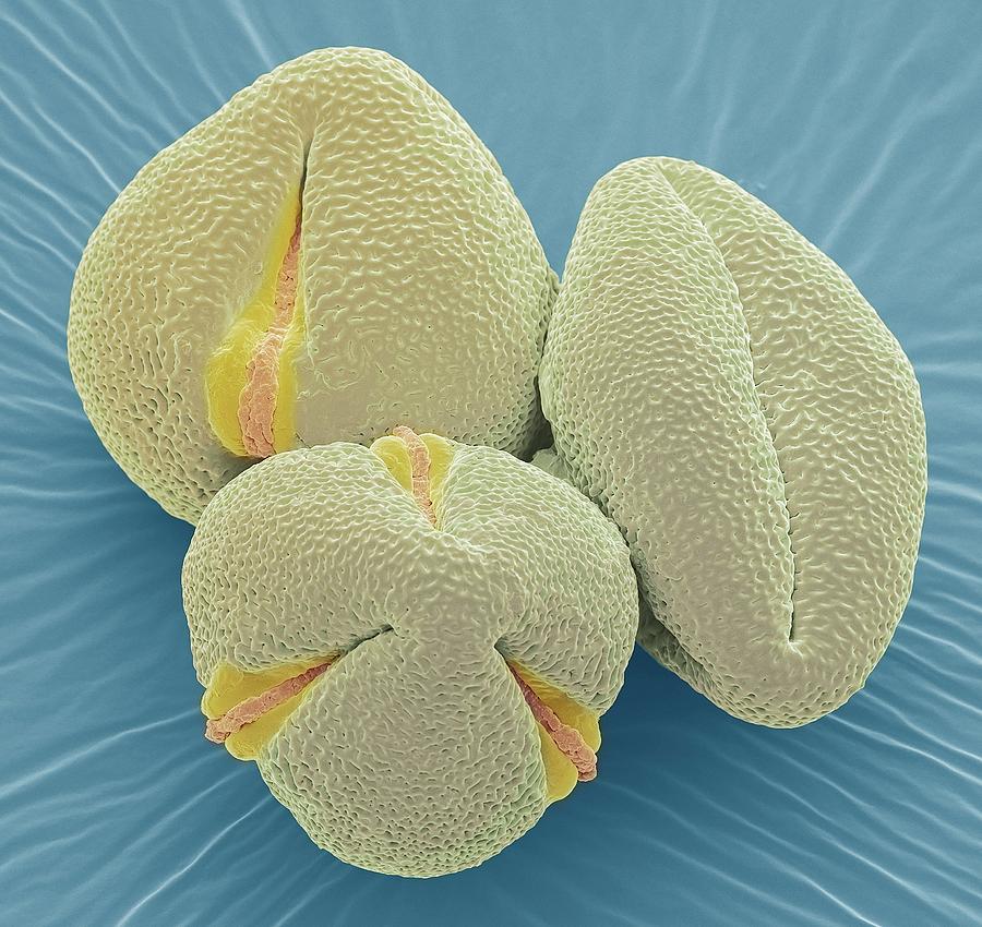 Euphorbia Pollen Grains. Sem #1 Photograph by Steve Gschmeissner