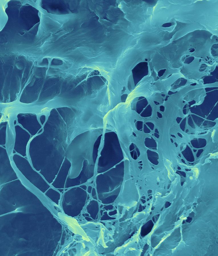 Extracellular Matrix #1 Photograph by Dennis Kunkel Microscopy/science Photo Library