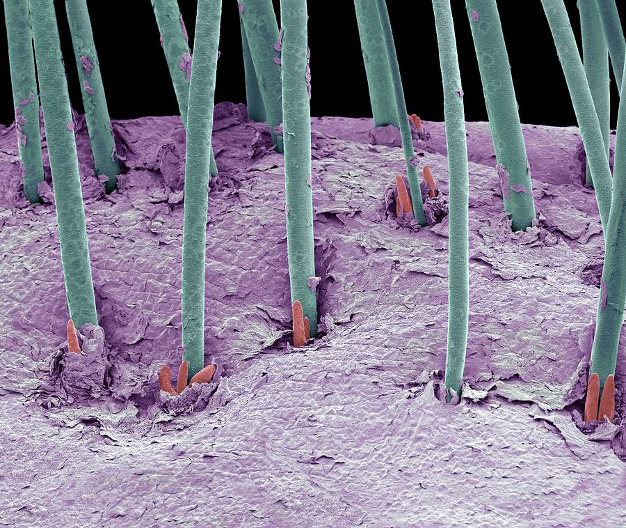 Eyelash Mites #1 Photograph by Steve Gschmeissner/science Photo Library