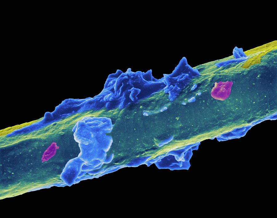 Eyelash With Mascara Photograph by Dennis Kunkel Microscopy/science