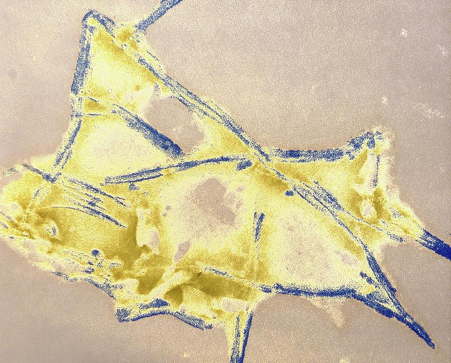 False-col Tem Of Fibrils In Mad Cow Disease #1 Photograph by Em Unit, Cvl, Weybridge/science Photo Library