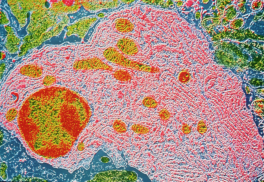 False-colour Tem Of A Human Plasmocyte #1 by Cnri/science Photo Library