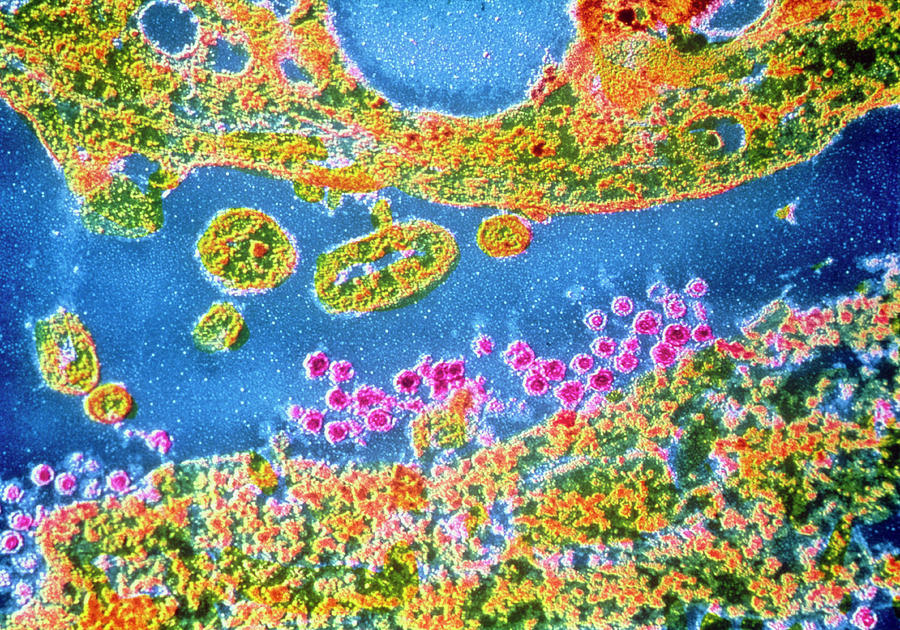 False Colour Tem Of Rubella Virus Particles Photograph By Cnri Science