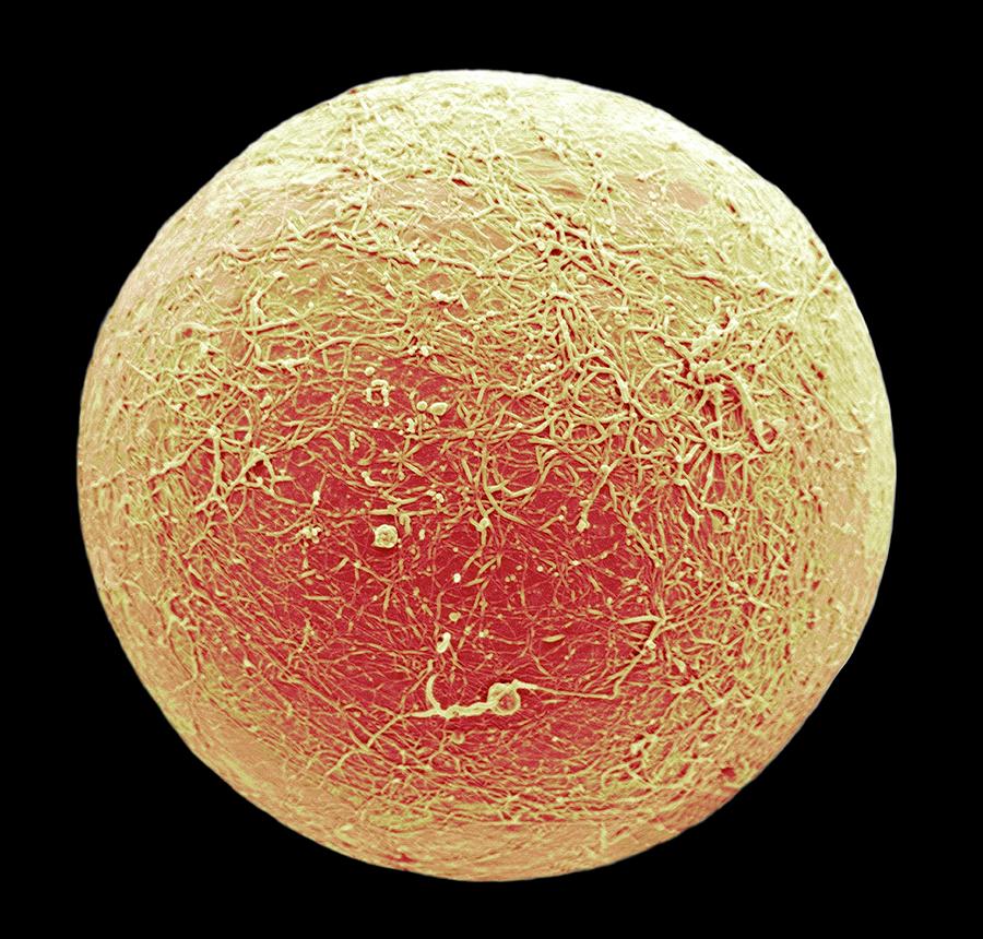 Fat Cell #1 Photograph by Steve Gschmeissner/science Photo Library
