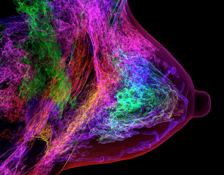 Female Breast #1 Photograph by K H Fung/science Photo Library