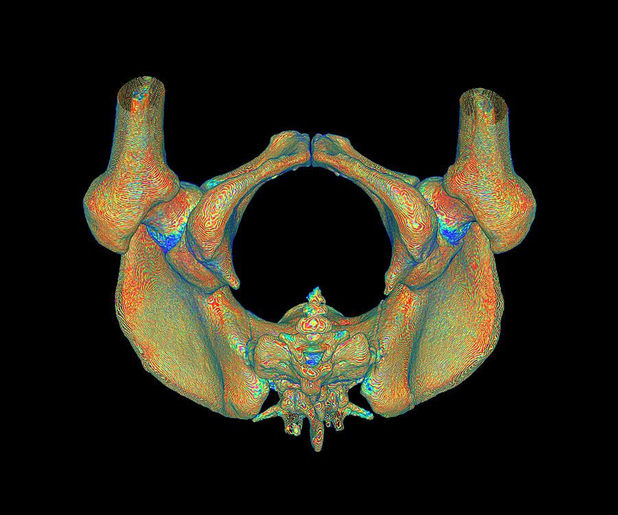 Skeleton Photograph - Female Pelvis #1 by K H Fung/science Photo Library