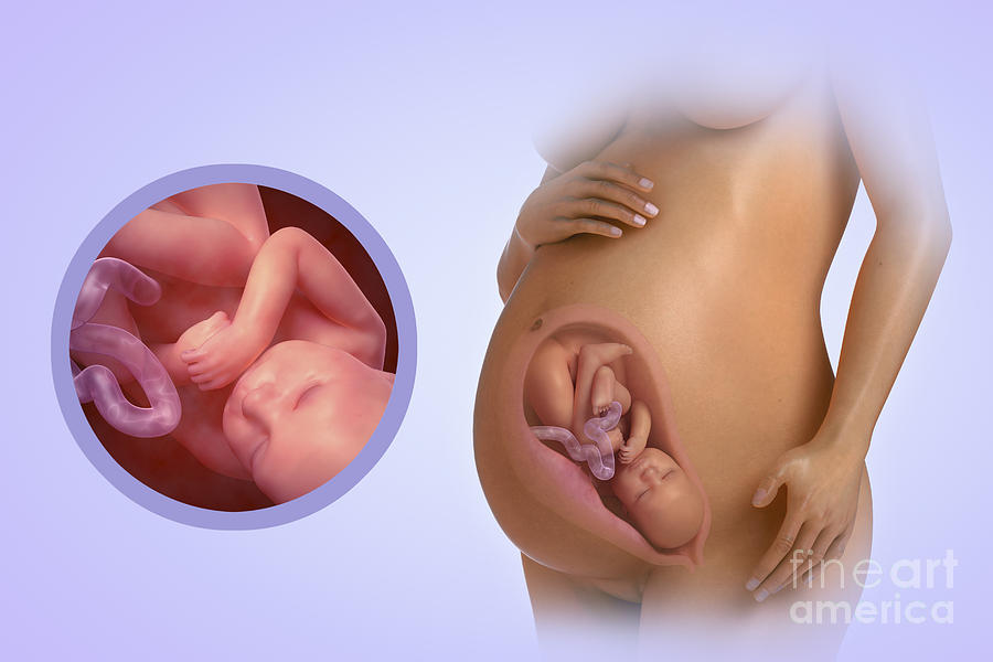 Diarrea 33 semanas embarazo