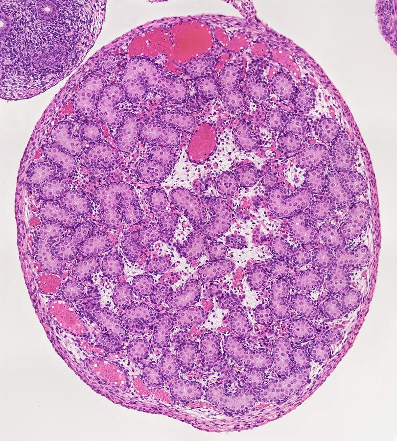 Fetal Testis Histology A Fetal Mouse Low Magnificatio - vrogue.co