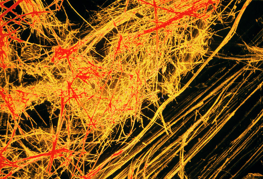 Fibres Of Blue Asbestos #1 Photograph by Dr Jeremy Burgess/science Photo Library.