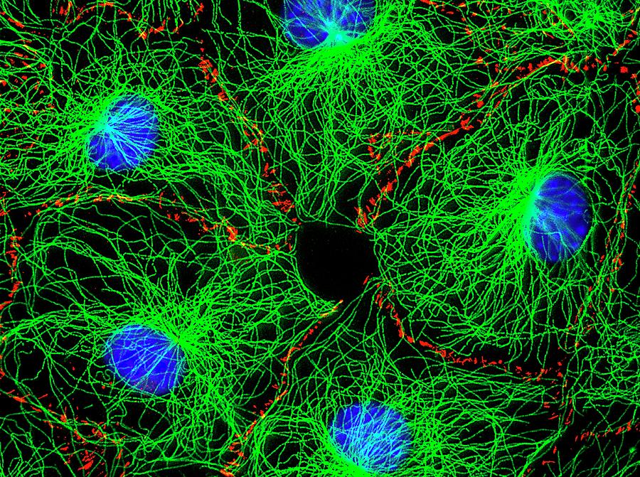 Fibroblast Cells #1 Photograph by Dr Jan Schmoranzer/science Photo Library