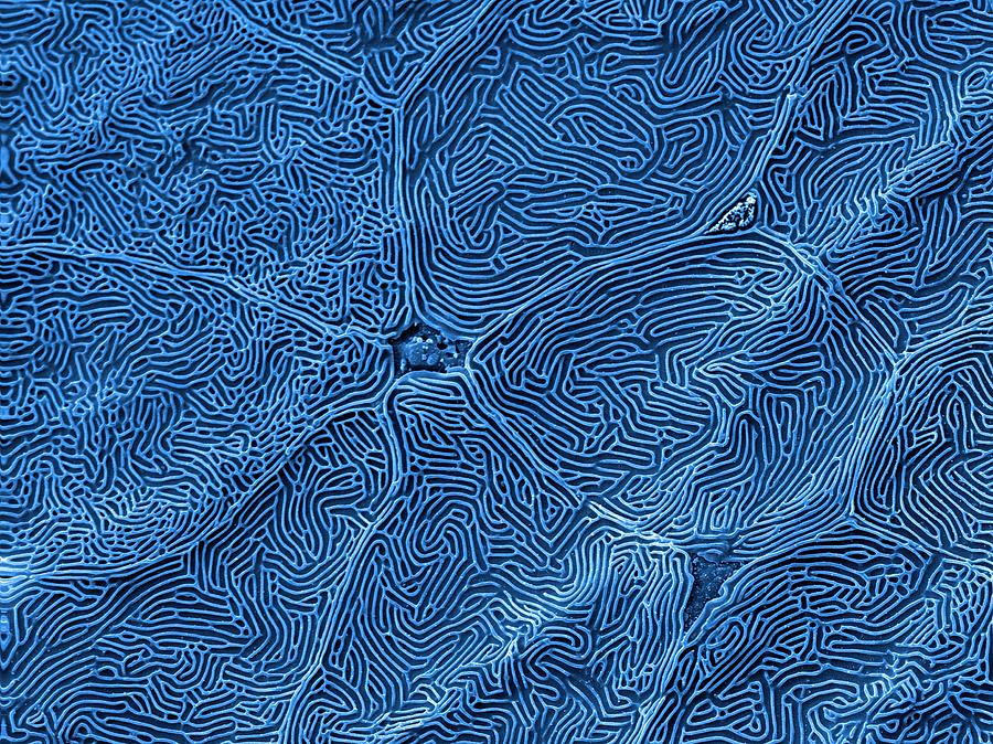 Fish Scale Photograph by Kevin Mackenzie / University Of Aberdeen / Science Photo Library