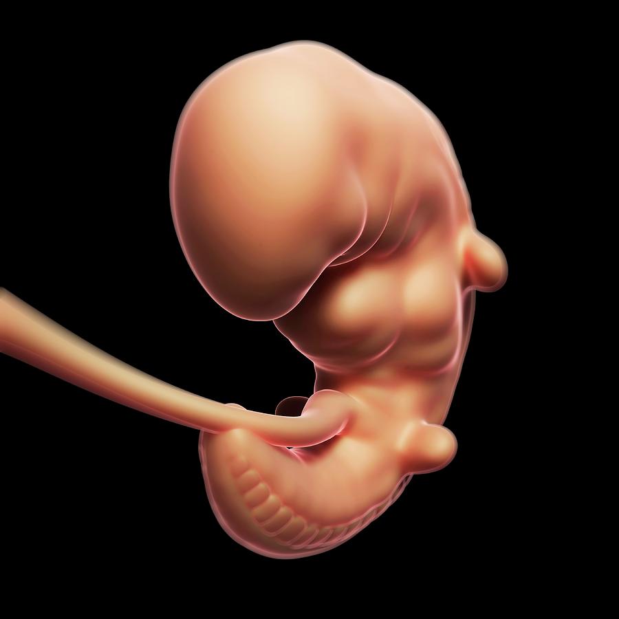 Foetus At 1 Month #1 Photograph by Sebastian Kaulitzki