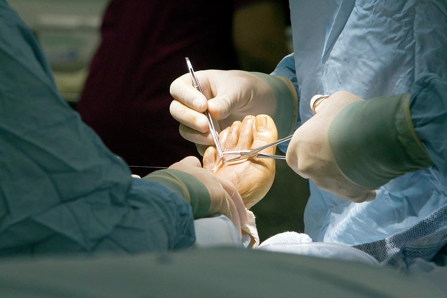 Foot Operation Photograph by Mark Thomas/science Photo Library
