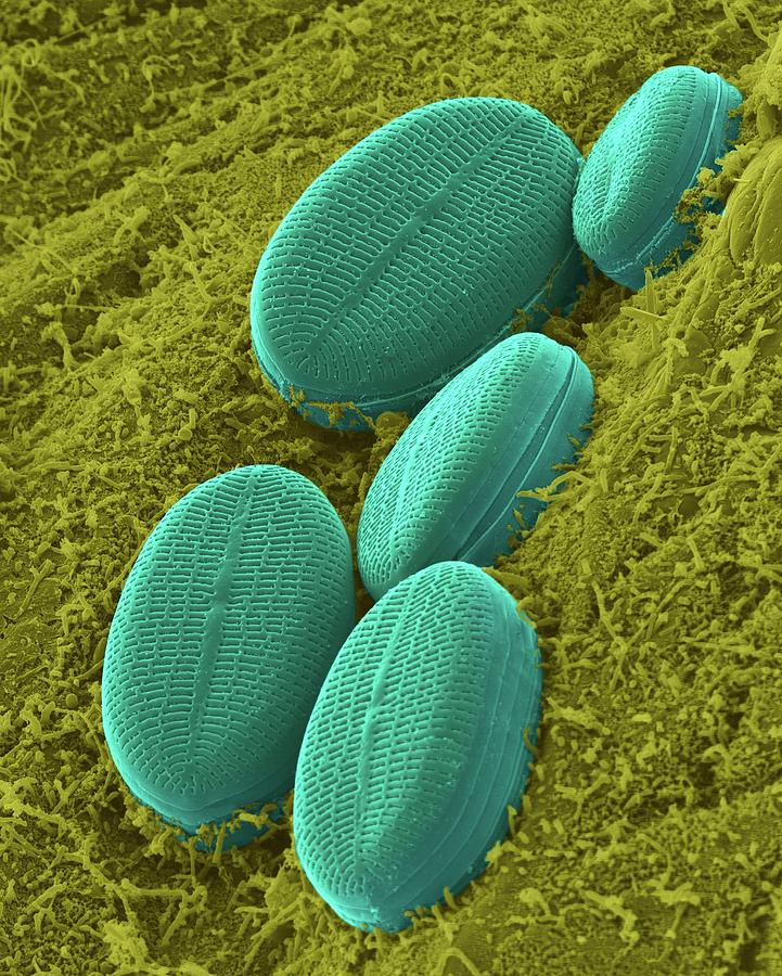 Fresh Water Pennate Diatom #1 Photograph by Dennis Kunkel Microscopy/science Photo Library
