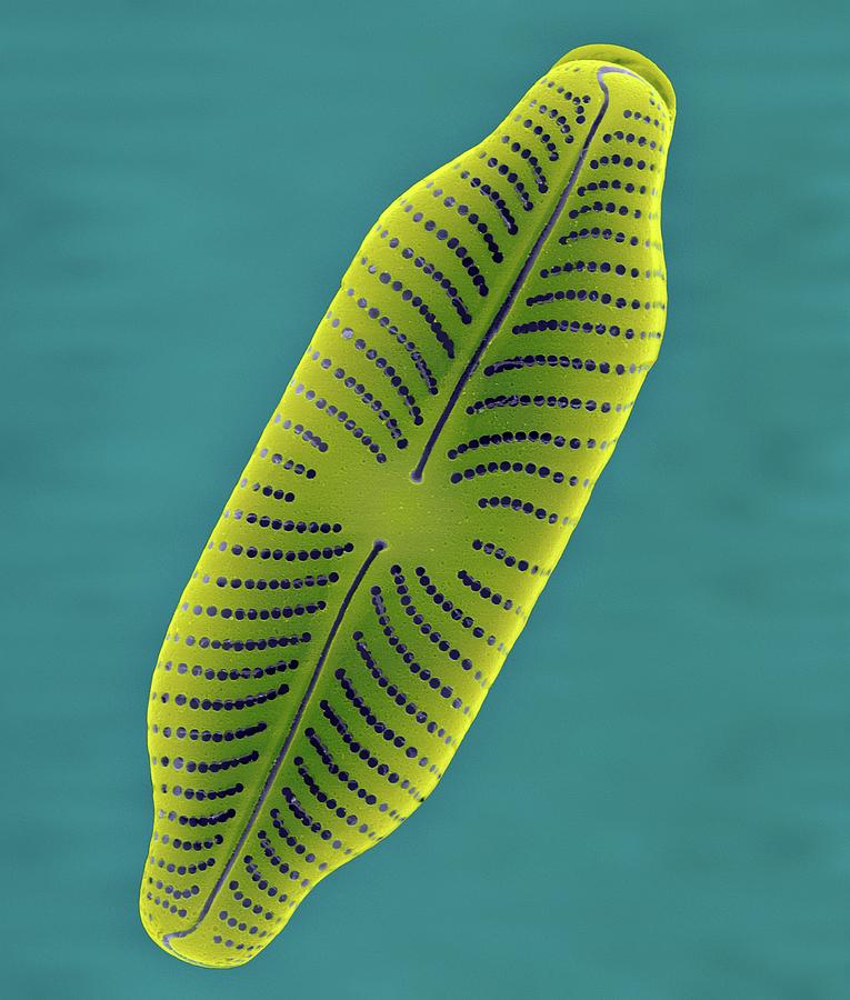 Fresh Water Pennate Diatom (navicula Sp.) #1 Photograph by Dennis Kunkel Microscopy/science Photo Library