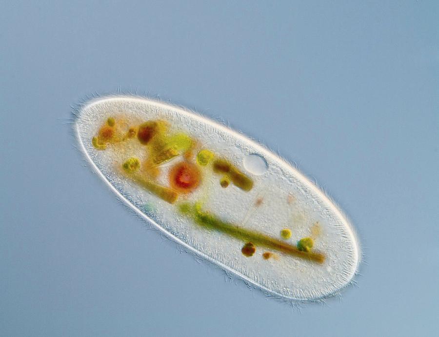 Frontonia Protist #1 Photograph by Gerd Guenther/science Photo Library