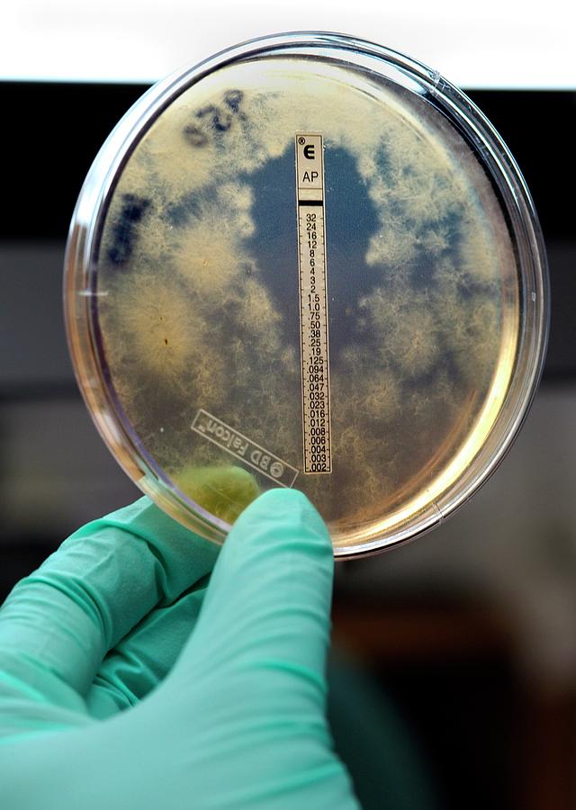 Fungal Meningitis Research Photograph by Cdc/science Photo Library ...