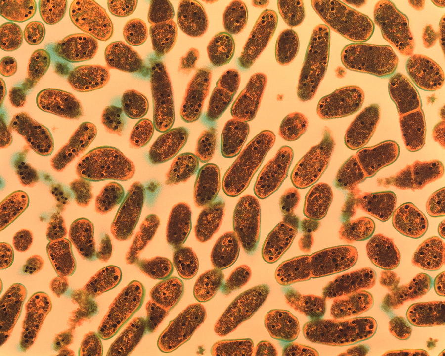 Gardnerella Vaginalis Bacteria 1 Photograph By Moredun Scientific Ltdscience Photo Library 6185