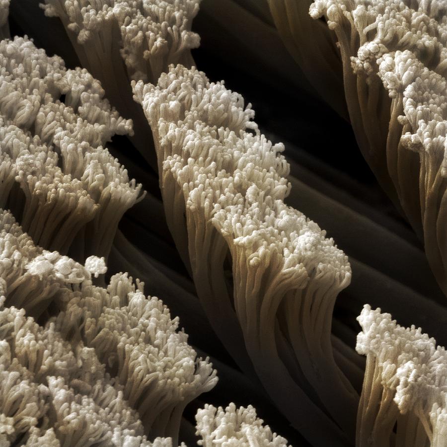 1-gecko-foot-hairs-sem-power-and-syred.jpg