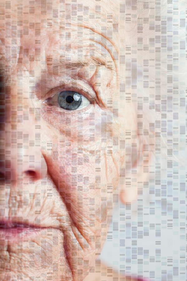 Autoradiogram Photograph - Genetics Of Ageing #1 by Cristina Pedrazzini/science Photo Library