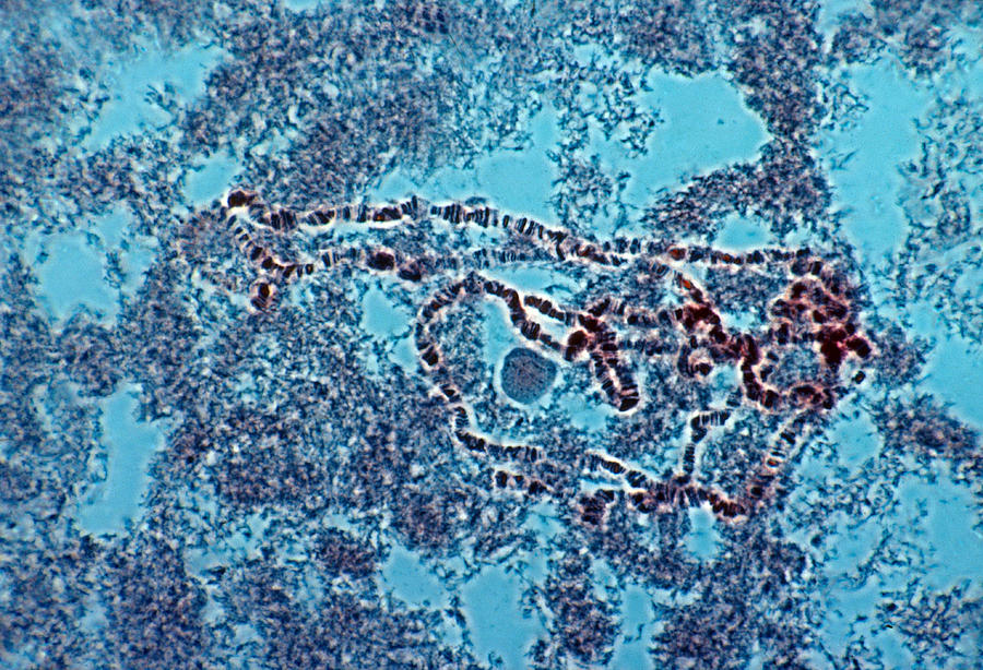 Giant Chromosomes From Fruit Fly #1 Photograph by Joseph F. Gennaro Jr.