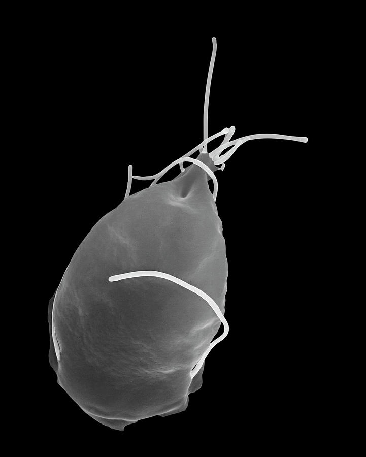 Black And White Photograph - Giardia Lamblia #1 by Dennis Kunkel Microscopy/science Photo Library