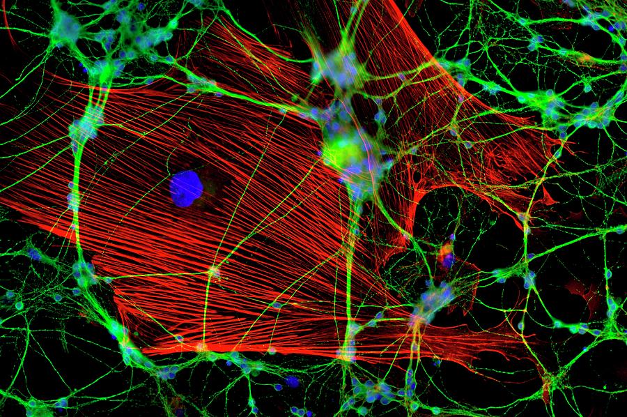 Glial Cells #1 Photograph by Dr Jan Schmoranzer/science Photo Library