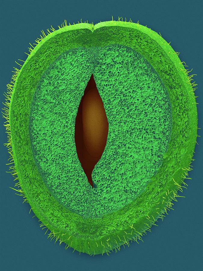 Green Bean Parenchyma Cells And Seed #1 Photograph by Dennis Kunkel Microscopy/science Photo Library
