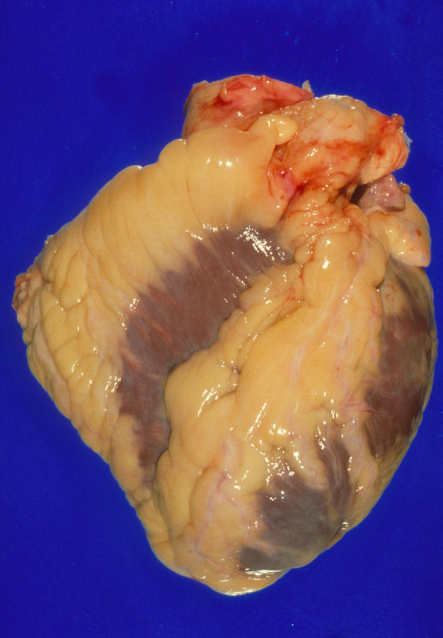 Heart Photograph - Gross Specimen Of A Healthy Human Heart #1 by Science Photo Library
