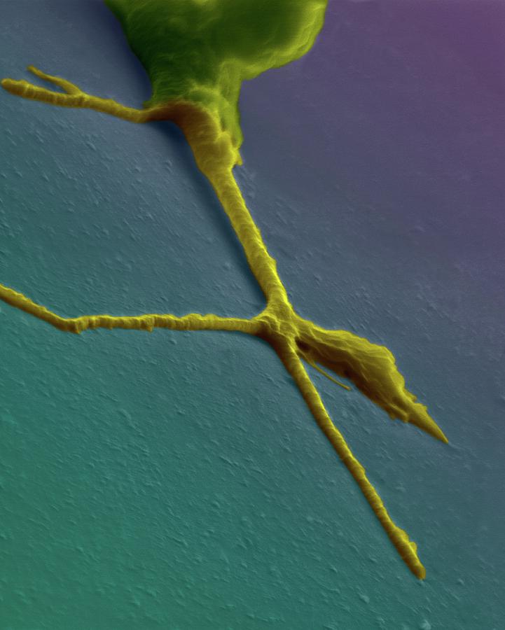 Growth Cone From A Developing Neuron #1 Photograph by Dennis Kunkel Microscopy/science Photo Library
