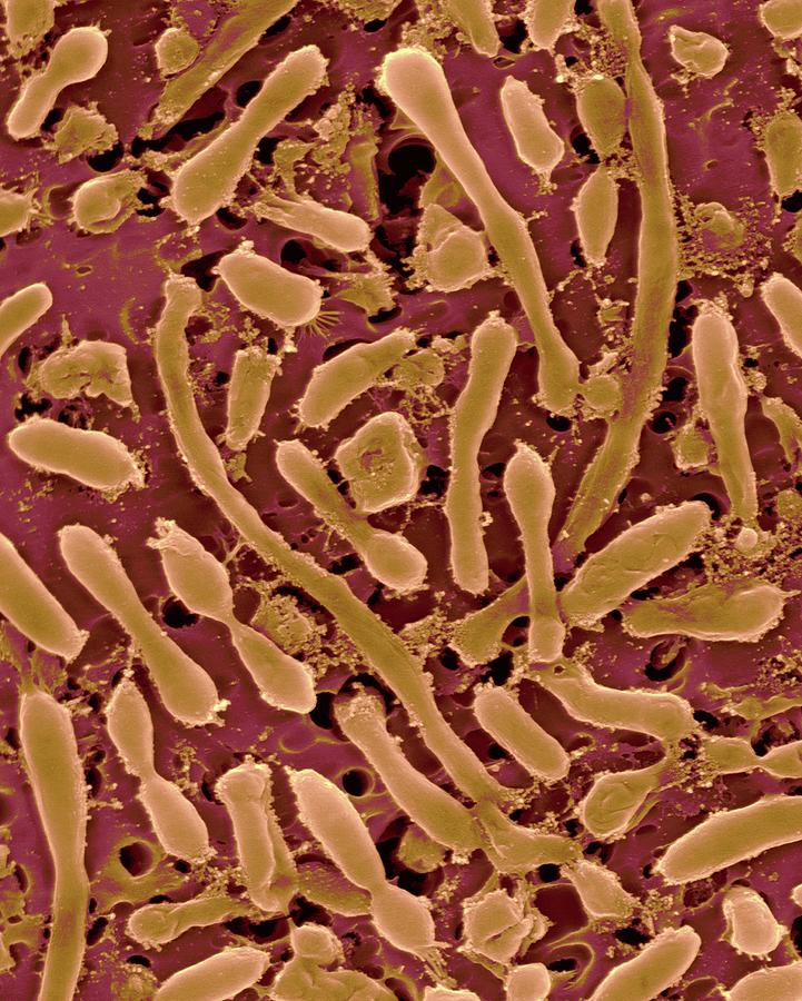 Halophilic Archaea Photograph by Dennis Kunkel Microscopy/science Photo ...