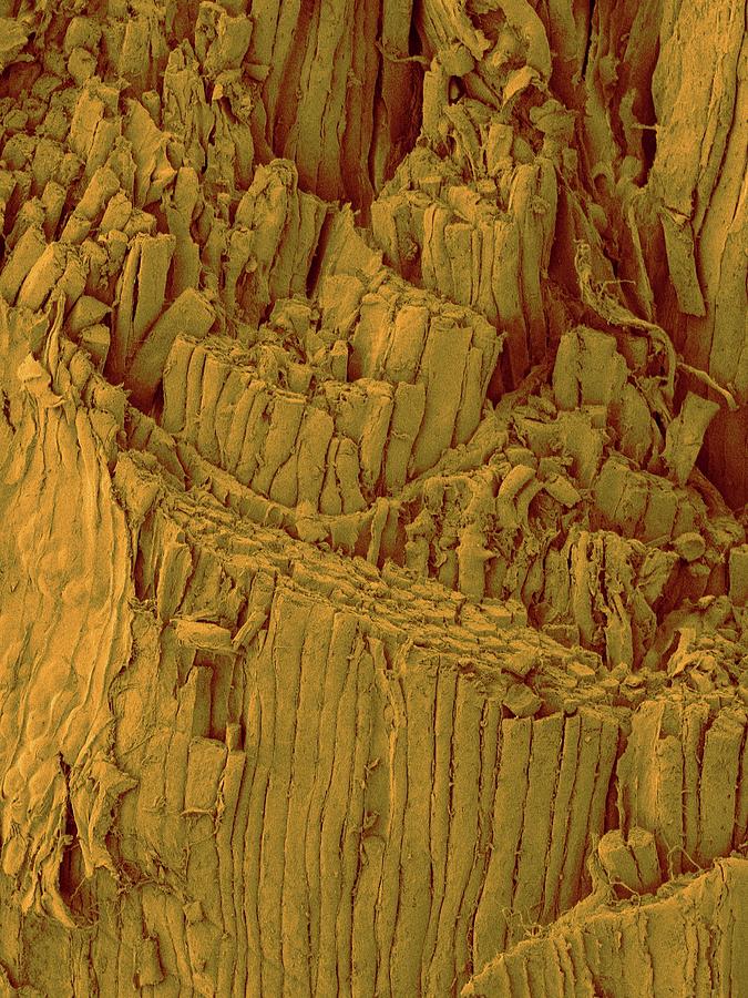 Ham Shank Muscle Fibres #1 Photograph by Dennis Kunkel Microscopy/science Photo Library