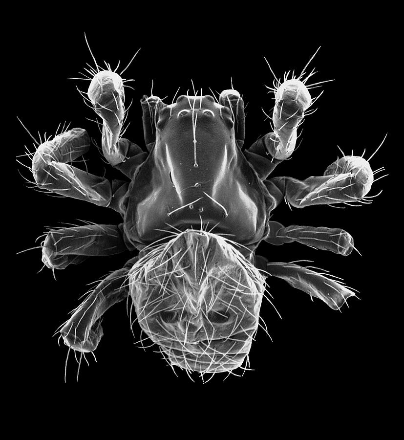 Hammock Spider (pityohyphantes Costatus) #1 Photograph by Dennis Kunkel Microscopy/science Photo Library