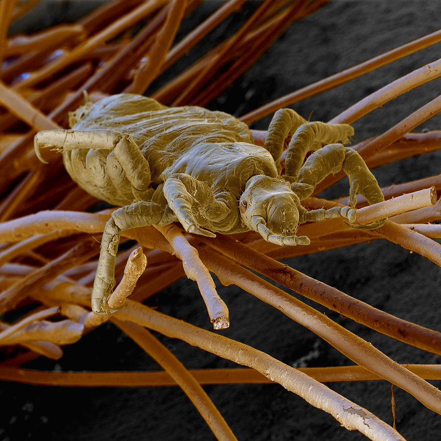 Head Lice #1 Photograph by Eye of Science