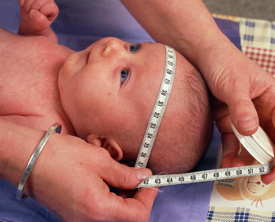 Head Of A One Month Old Baby Girl Being Measured #1 Photograph by Simon Fraser/science Photo Library
