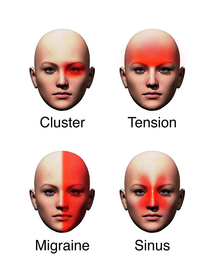 Headache Types #1 Photograph by Mikkel Juul Jensen - Pixels