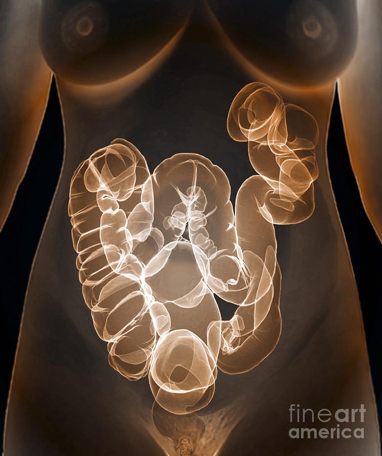 Large Intestine Photograph - Healthy Large Intestine, 3d Ct Scan #1 by Zephyr