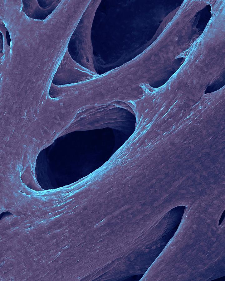 Heart Atrium Muscle Fibres #1 Photograph by Dennis Kunkel Microscopy/science Photo Library